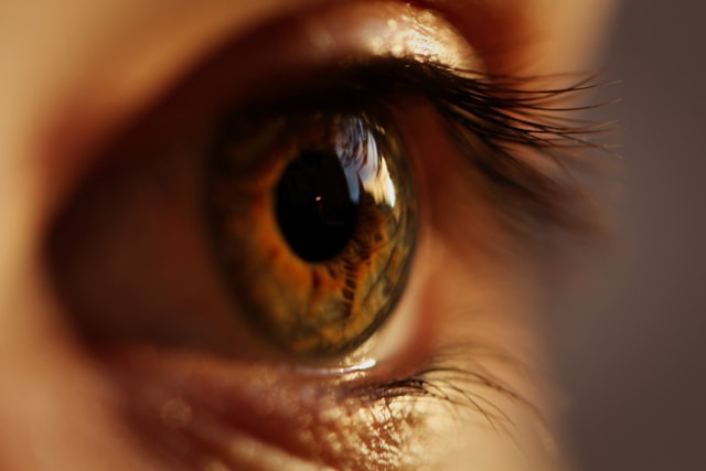 Auge